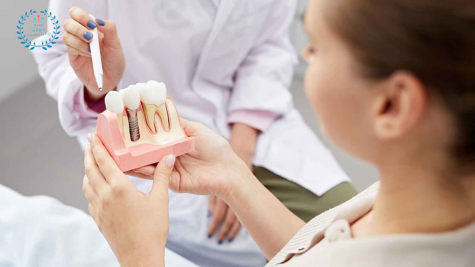Best Dental Implants in Toronto