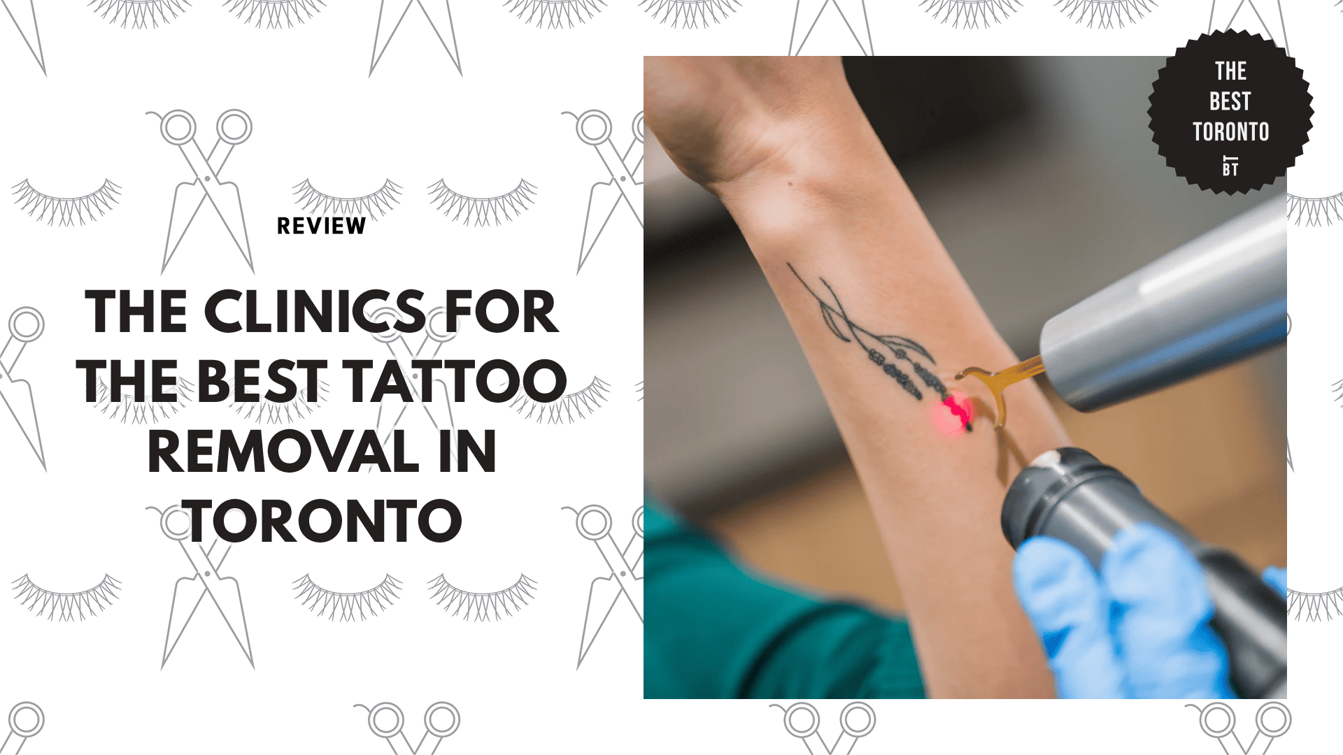 THE 7 CLINICS FOR THE BEST TATTOO REMOVAL IN TORONTO
