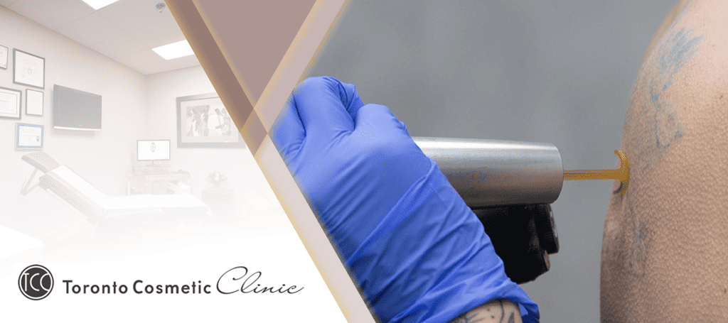 Toronto Cosmetic Clinics Banner