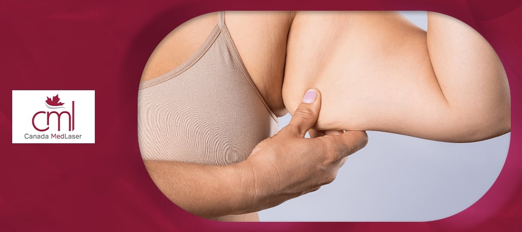 Canada MedLaser Clinic