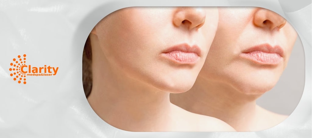 Clarity MedSpa and Laser