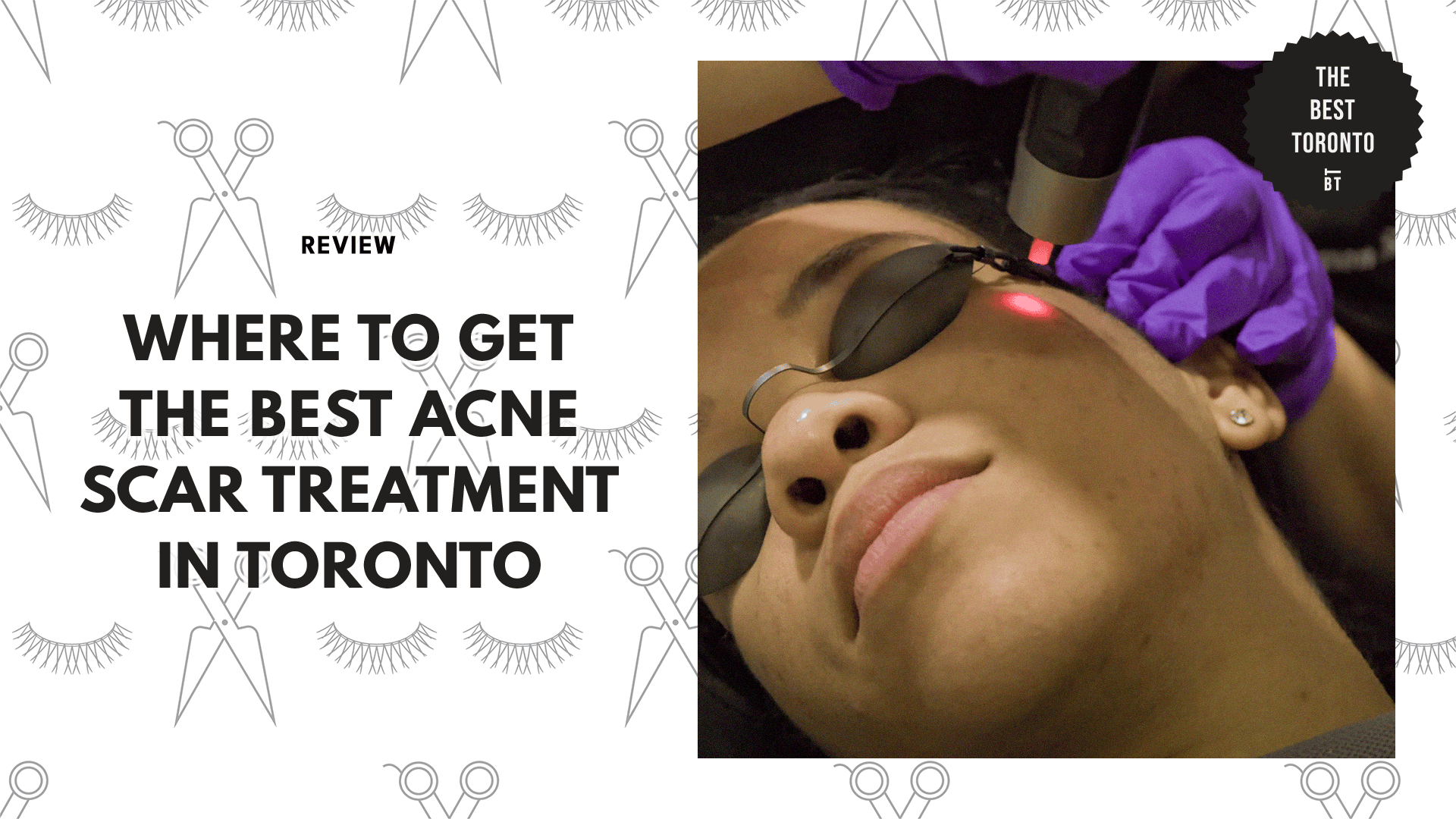 acne-scar-treatment