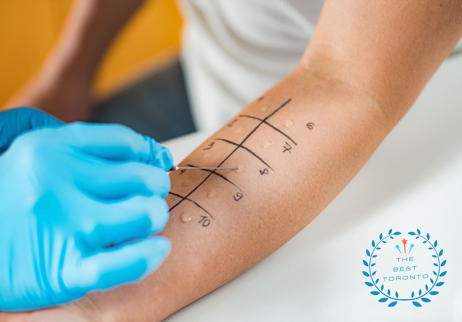 5 BEST ALLERGY SPECIALISTS IN TORONTO