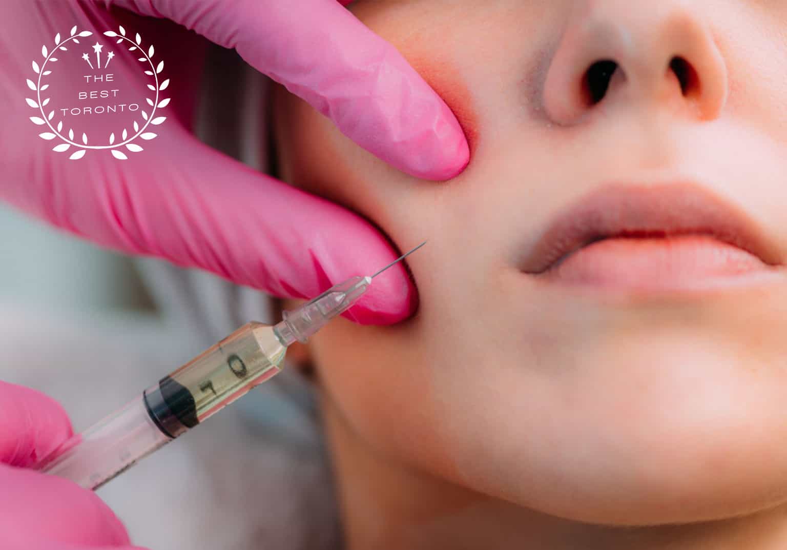 5 BEST CLINICS FOR DERMAL FILLERS IN TORONTO