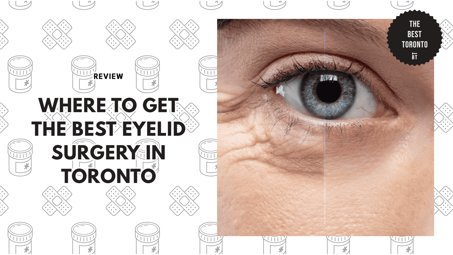 eyelid-surgery-in-toronto