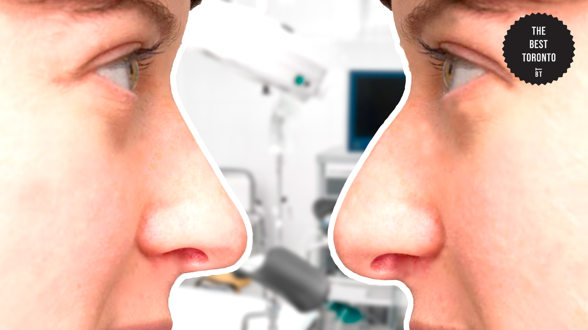 Rhinoplasty Procedures in Toronto: Uncovering the Types