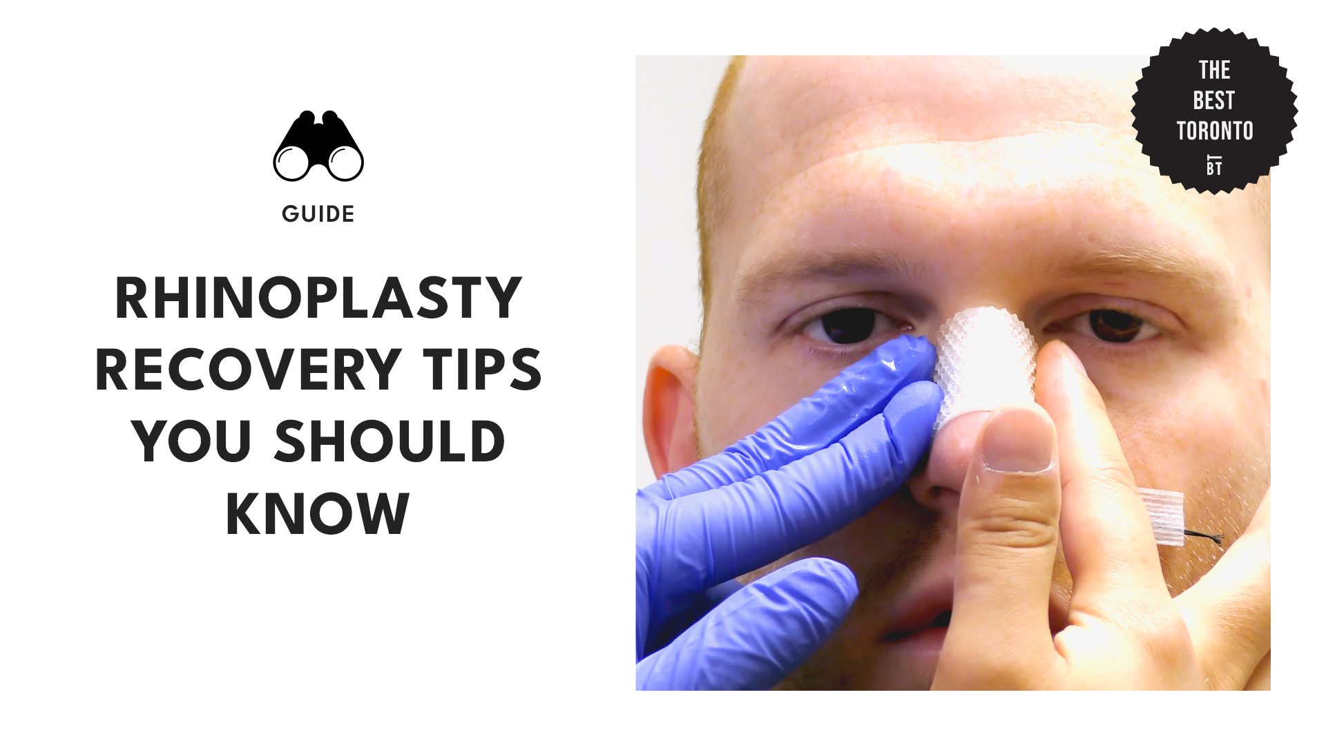 Best Rhinoplasty Recovery Tips