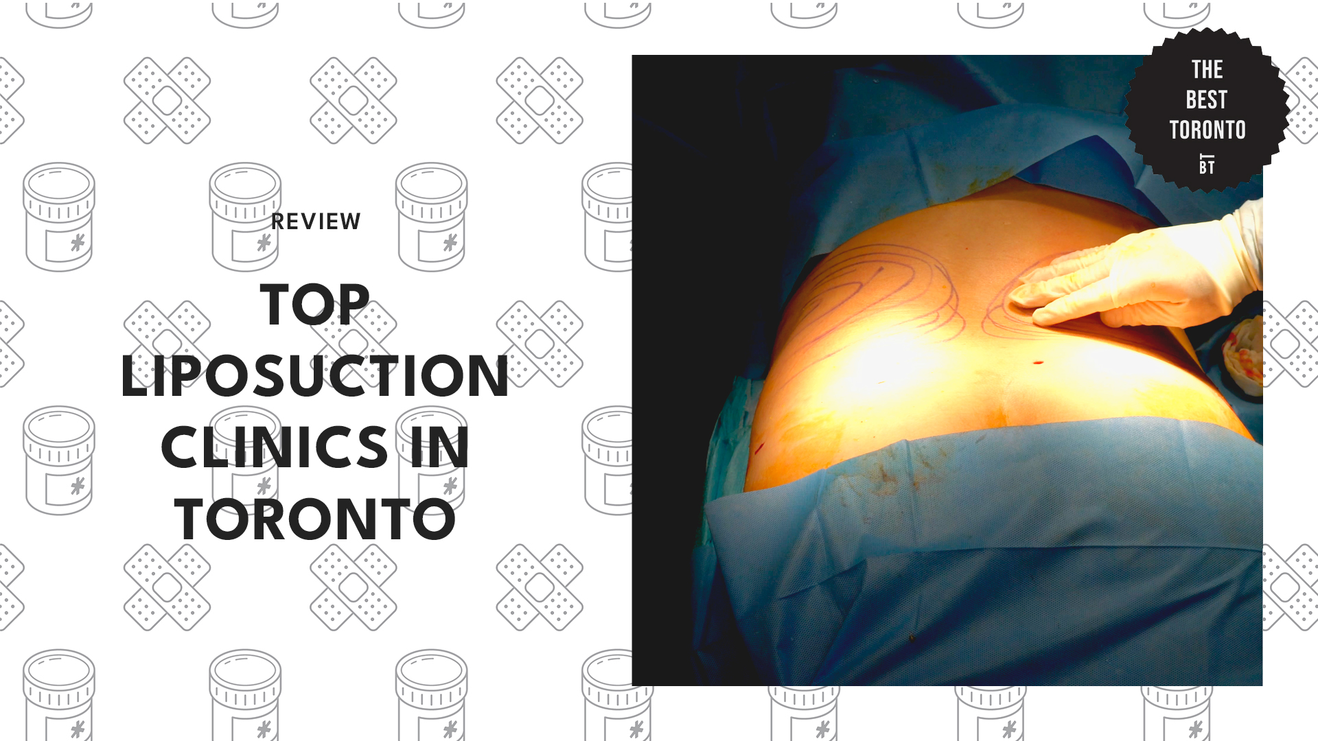 top-liposuction-clinics-toronto