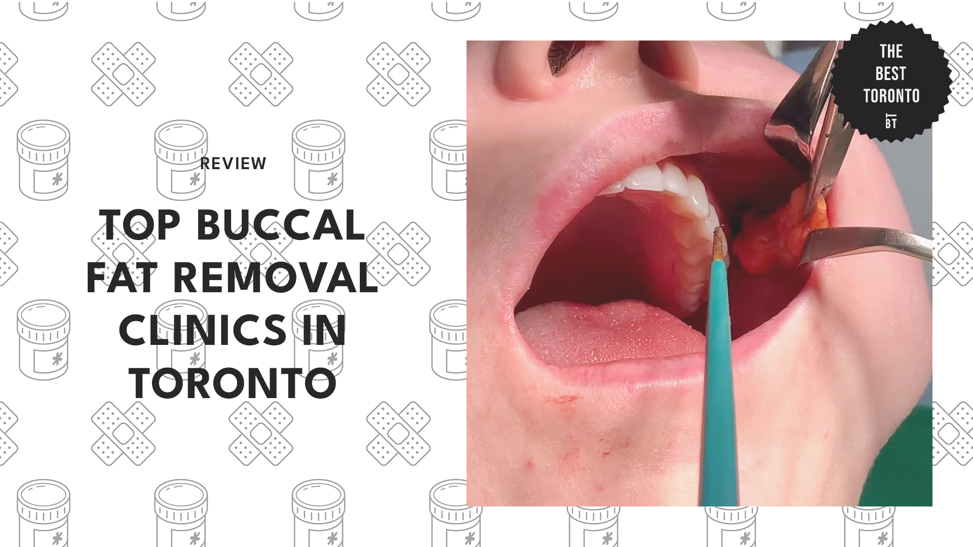 top-buccal-fat-removal-clinics-toronto