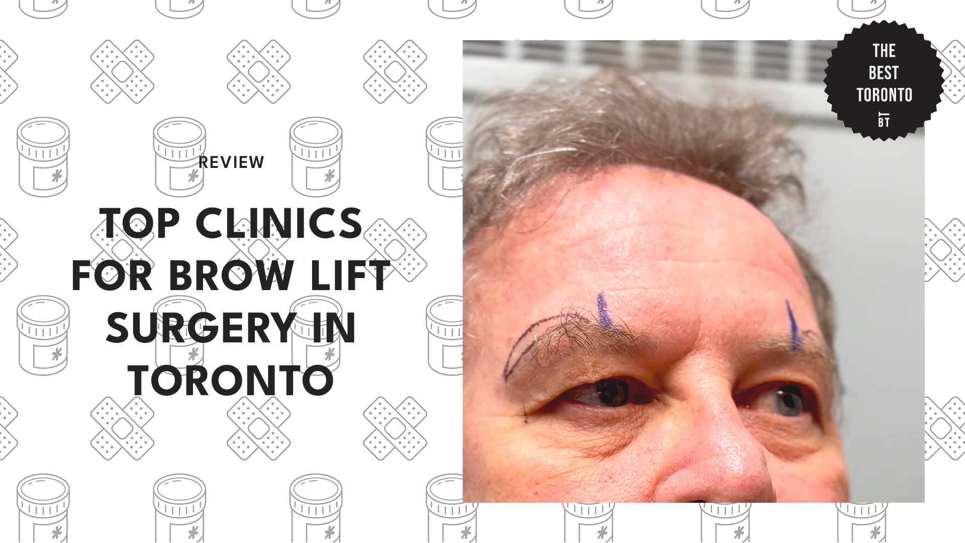 top-brow-lift-surgery-clinics-toronto