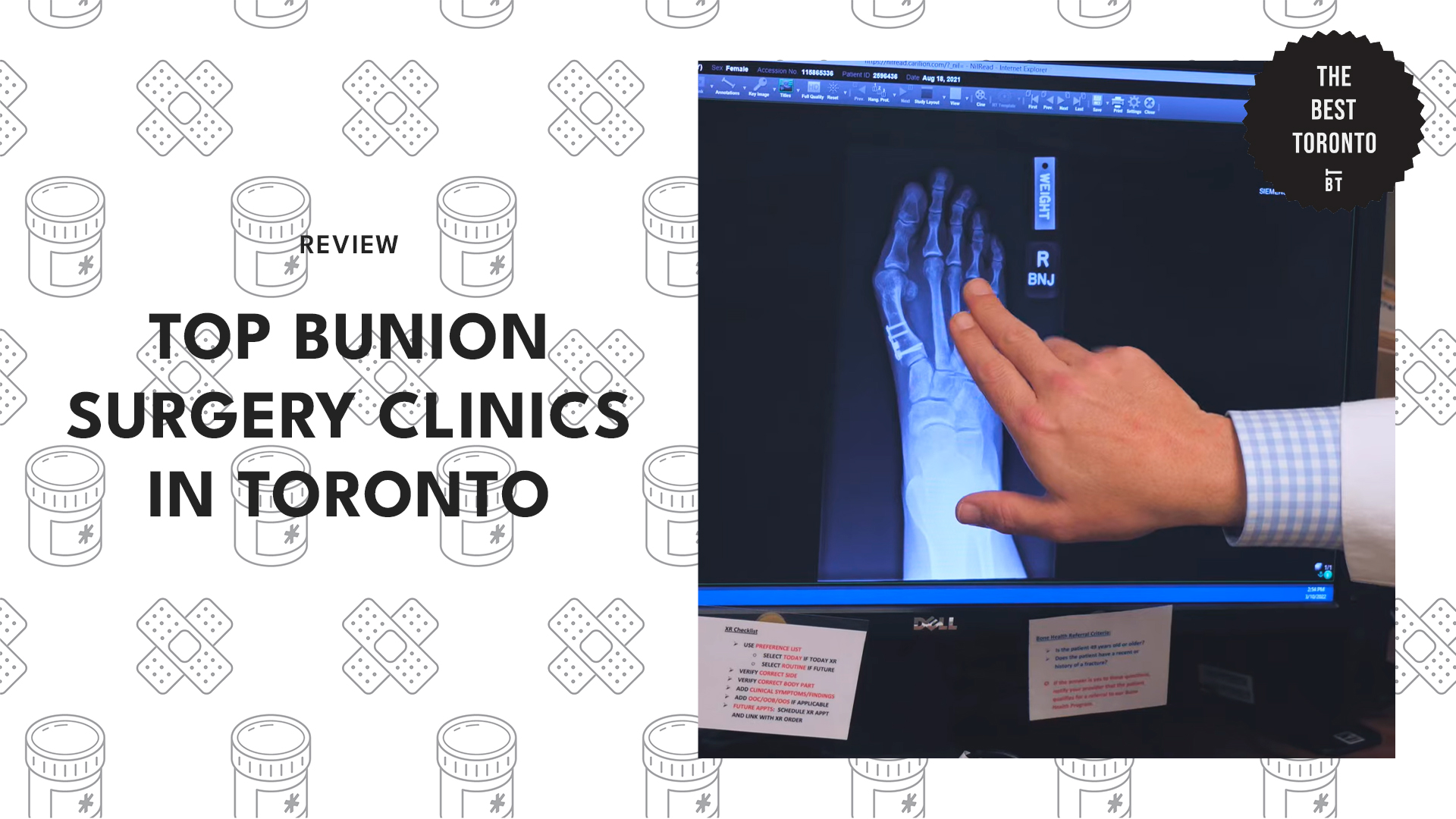 top-bunion-surgery-clinics-toronto