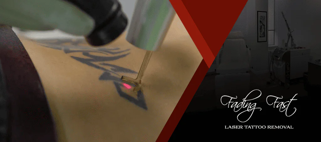 Fading Fast Laser Tattoo Removal's Banner