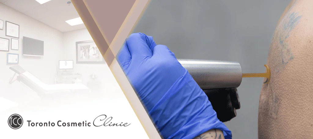 Toronto Cosmetic Clinics Banner