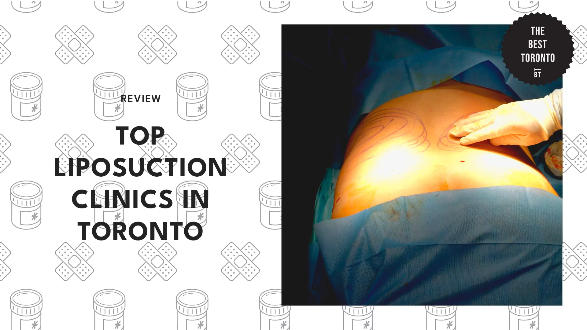 top-liposuction-clinics-toronto